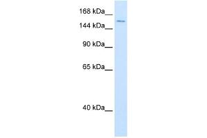 WB Suggested Anti-DHX9 Antibody Titration:  0. (DHX9 抗体  (N-Term))