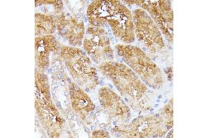 Immunohistochemistry of paraffin-embedded rat kidney using CLNS1A antibody (ABIN7266334) at dilution of 1:100 (40x lens).