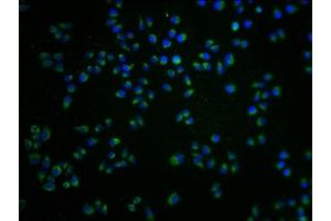 Immunofluorescence staining of Hela cells with ABIN7168054 at 1:100, counter-stained with DAPI. (GRK7 抗体  (AA 342-550))