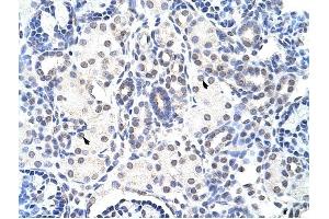 NIP7 antibody was used for immunohistochemistry at a concentration of 4-8 ug/ml to stain Epithelial cells of renal tubule (arrows) in Human Kidney. (NIP7 抗体)