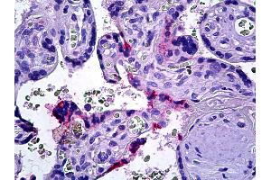 Anti-DOK3 antibody IHC of human placenta. (DOK3 抗体  (AA 484-496))
