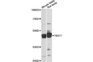 Western blot analysis of extracts of various cell lines, using TEKT1 antibody (ABIN6290784) at 1:1000 dilution. (TEKT1 抗体)