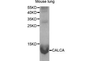 Western Blotting (WB) image for anti-Calcitonin-Related Polypeptide alpha (CALCA) antibody (ABIN1876765) (CGRP 抗体)