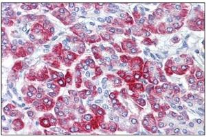 Human Pancreas: Formalin-Fixed, Paraffin-Embedded (FFPE) (RPS6 抗体  (C-Term))