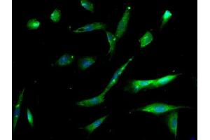 Image provided by One World Lab validation program. (Integrin Alpha3, Beta1 (AA 976-1025) 抗体)