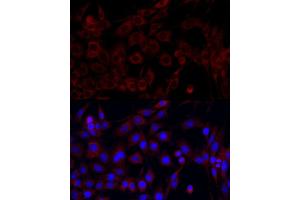 Immunofluorescence analysis of PC-12 cells using PI3 Kinase p85 alpha antibody (ABIN6130617, ABIN6145642, ABIN6145645 and ABIN6215197) at dilution of 1:100. (PIK3R1 抗体  (AA 240-380))