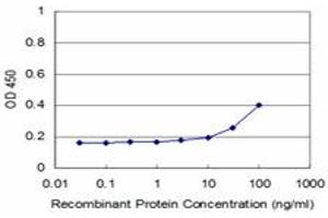 Detection limit for recombinant GST tagged RIPK4 is approximately 3ng/ml as a capture antibody. (RIPK4 抗体  (AA 675-784))