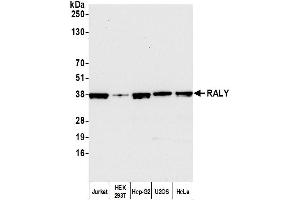 Western Blotting (WB) image for anti-RNA-binding protein Raly (RALY) (AA 256-306) antibody (ABIN7454547)