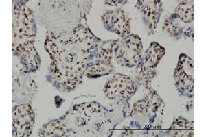 Immunohistochemistry (Formalin-fixed Paraffin-embedded Sections) (IHC (fp)) image for anti-TAF7 RNA Polymerase II, TATA Box Binding Protein (TBP)-Associated Factor, 55kDa (TAF7) (AA 130-224) antibody (ABIN563086)