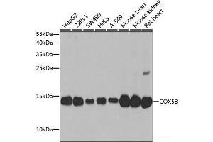 Western blot analysis of extracts of various cell lines using COX5B Polyclonal Antibody at dilution of 1:1000. (COX5B 抗体)
