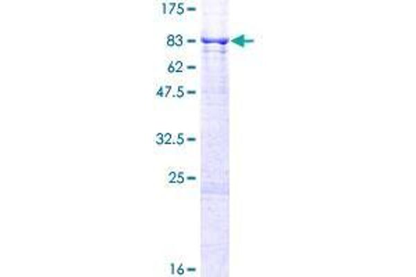 CYP4V2 Protein (AA 1-525) (GST tag)