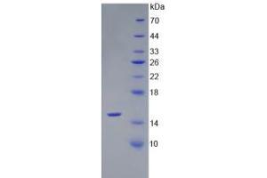 SDS-PAGE analysis of Rat AMH Protein. (AMH 蛋白)