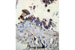 FCN3 Antibody (C-term) immunohistochemistry analysis in formalin fixed and paraffin embedded human lung tissue followed by peroxidase conjugation of the secondary antibody and DAB staining. (FCN3 抗体  (C-Term))