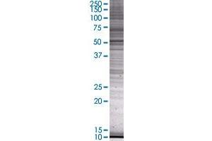Western Blotting (WB) image for CYP1A1 293T Cell Transient Overexpression Lysate(Denatured) (ABIN1331508)