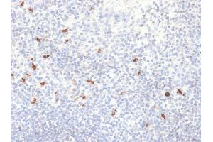 Formalin-fixed, paraffin-embedded human Tonsil stained with IgG4 Recombinant Rabbit Monoclonal Antibody (IGHG4/2042R). (Recombinant IGHG4 抗体)