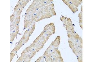 Immunohistochemistry of paraffin-embedded Mouse heart using ATAD3B Polyclonal Antibody at dilution of 1:100 (40x lens). (ATAD3B 抗体)