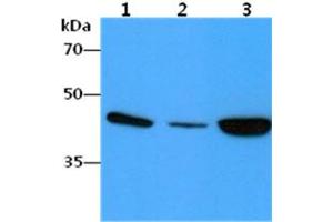 The cell lysates (40ug) were resolved by SDS-PAGE, transferred to PVDF membrane and probed with anti-human ACTA2 antibody (1:1000).