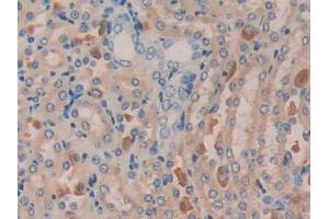 DAB staining on IHC-P; Samples: Mouse Kidney Tissue (MGEA5 抗体  (AA 83-222))