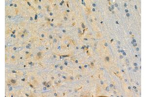 ABIN6261285 and ABIN6276758 at 1/100 staining Rat brain tissue by IHC-P. (Dihydrofolate Reductase 抗体  (N-Term))