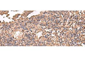 Immunohistochemistry of paraffin-embedded Human tonsil tissue using LDHAL6B Polyclonal Antibody at dilution of 1:65(x200) (LDHAL6B 抗体)