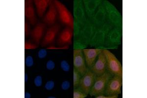 ALS2CR2 Mouse Monoclonal Antibody staining Hela cells by IF/ICC. (STRADB 抗体)