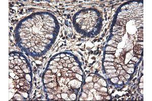Immunohistochemical staining of paraffin-embedded Human colon tissue using anti-TUBAL3 mouse monoclonal antibody. (TUBAL3 抗体  (AA 150-446))
