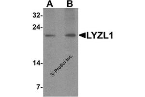 Western Blotting (WB) image for anti-Lysozyme-Like 1 (LYZL1) (N-Term) antibody (ABIN1587946) (Lysozyme-Like 1 抗体  (N-Term))