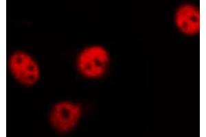 ABIN6267528 staining 293 by IF/ICC. (SAPK, JNK (pThr183) 抗体)