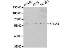 Western Blotting (WB) image for anti-Karyopherin (Importin) alpha 4 (KPNA4) antibody (ABIN1873459) (KPNA4 抗体)