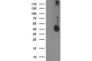 Western Blotting (WB) image for anti-Microtubule-Associated Protein, RP/EB Family, Member 2 (MAPRE2) antibody (ABIN1499317) (MAPRE2 抗体)