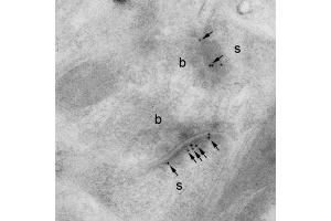 Electron micrograph of K28/43 hippocampal labelling using a post-embedding immunogold method.