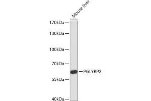 Western blot analysis of extracts of Mouse liver, using PGLYRP2 antibody (ABIN7269206) at 1:1000 dilution. (PGLYRP2 抗体)