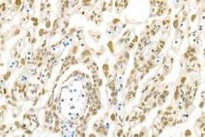 Immunohistochemistry analysis of paraffin-embedded rat placenta using,PNN (ABIN7075083) at dilution of 1: 1200 (PNN 抗体)