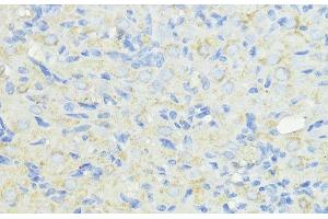 Immunohistochemistry of paraffin-embedded Rat ovary using CTSB Polyclonal Antibody at dilution of 1:100 (40x lens). (Cathepsin B 抗体)