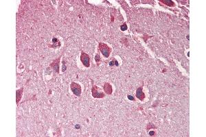 Anti-MXRA5 antibody IHC staining of human brain, cortex. (Adlican 抗体  (AA 1454-1467))