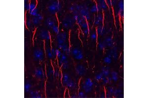 Immunofluorescence labeling of axon initial segments in adult rat cortex with N106/65 TC supe (red) and Hoechst nuclear stain (blue).
