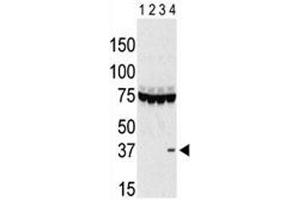 Western blot testing of Aurora-C antibody and lysate of 293 cells expressing 1) Flag tag, 2) Flag-tagged -A, 3) -B and 4) Aurora-C. (Aurora Kinase C 抗体  (AA 115-145))