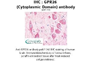 Image no. 1 for anti-G Protein-Coupled Receptor 26 (GPR26) (3rd Cytoplasmic Domain) antibody (ABIN1735037) (GPR26 抗体  (3rd Cytoplasmic Domain))