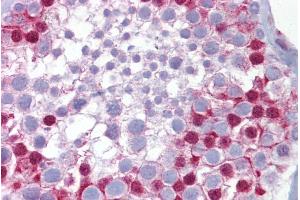 Immunohistochemistry with Testis tissue at an antibody concentration of 5µg/ml using anti-SP7 antibody (ARP32231_P050) (SP7 抗体  (N-Term))