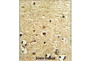 Formalin-fixed and paraffin-embedded human brain tissue with OLIG3 Antibody (Center), which was peroxidase-conjugated to the secondary antibody, followed by DAB staining. (OLIG3 抗体  (AA 74-100))