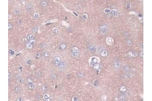 Detection of ANGPT1 in Rat Cerebrum Tissue using Polyclonal Antibody to Angiopoietin 1 (ANGPT1) (Angiopoietin 1 抗体  (AA 304-450))