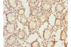 Immunohistochemistry of paraffin-embedded human colon tissue using ABIN7142076 at dilution of 1:100 (RDH5 抗体  (AA 24-318))