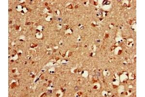 Immunohistochemistry of paraffin-embedded human brain tissue using ABIN7152652 at dilution of 1:100 (FAAH 抗体  (AA 205-342))