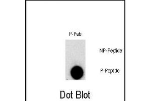 Dot blot analysis of Phospho-FGFR1- polyclonal antibody `a on nitrocellulose membrane. (FGFR1 抗体  (pTyr307))