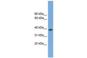 Image no. 1 for anti-Wingless-Type MMTV Integration Site Family, Member 3 (WNT3) (AA 143-192) antibody (ABIN6744872) (WNT3 抗体  (AA 143-192))