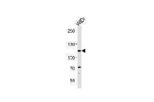 CARD6 Antibody (Center) (ABIN1881136 and ABIN2842626) western blot analysis in WiDr cell line lysates (35 μg/lane). (CARD6 抗体  (AA 755-787))