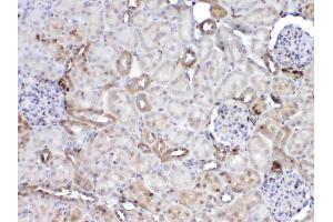 Immunohistochemistry (IHC) image for anti-Glutathione S-Transferase pi 1 (GSTP1) (AA 2-210) antibody (ABIN5518996)