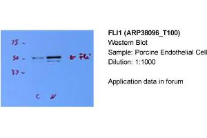Western Blotting (WB) image for anti-Friend Leukemia Virus Integration 1 (FLI1) (N-Term) antibody (ABIN2780392) (FLI1 抗体  (N-Term))
