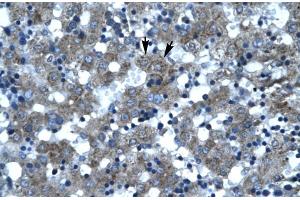 Rabbit Anti-SUPT3H Antibody Catalog Number: ARP30038 Paraffin Embedded Tissue: Human Liver Cellular Data: Hepatocytes Antibody Concentration: 4. (SUPT3H/SPT3 抗体  (N-Term))