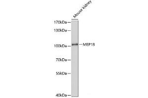 Western blot analysis of extracts of Mouse kidney using MEP1B Polyclonal Antibody at dilution of 1:1000. (Meprin B 抗体)